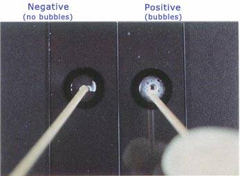 staphylococcus aureus catalase test